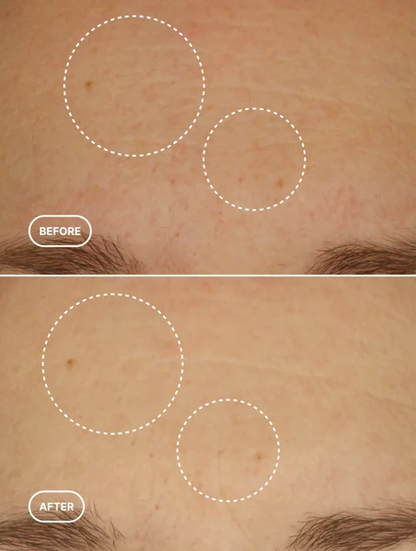 Retinol Alternative Serum